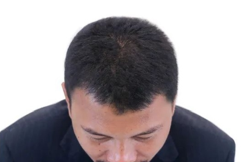 hair-after