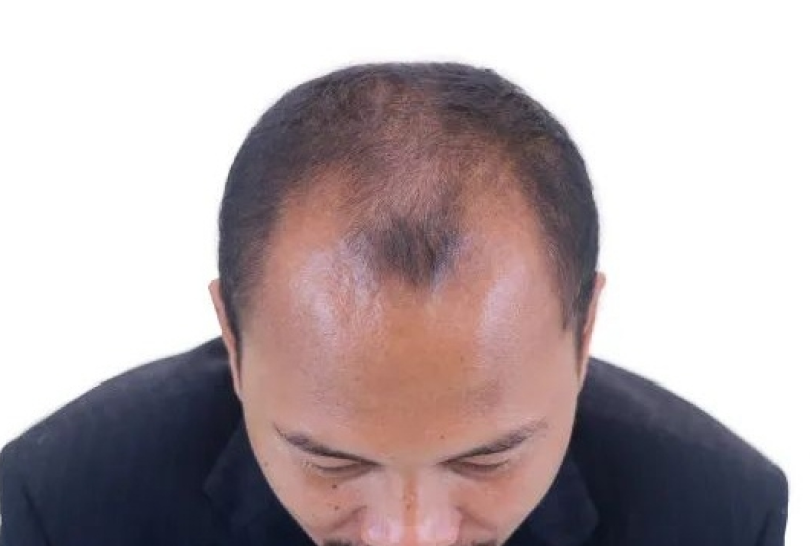 hair-before